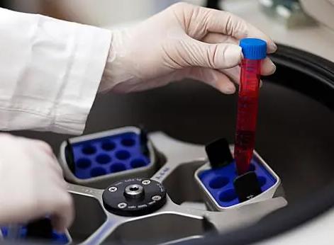 Refrigerated Centrifuge work with blood components separation
